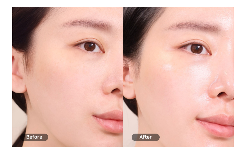 ビフォーアフター